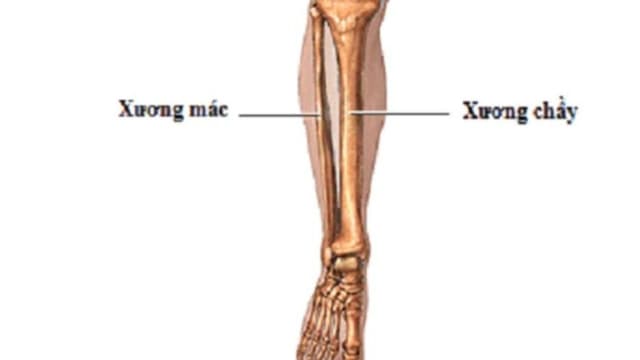 Nhận biết sớm các dấu hiệu gãy xương mác để điều trị kịp thời