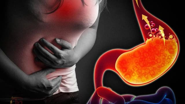 Tại sao bạn bị ợ hơi nóng bụng và khi nào nên lo lắng?