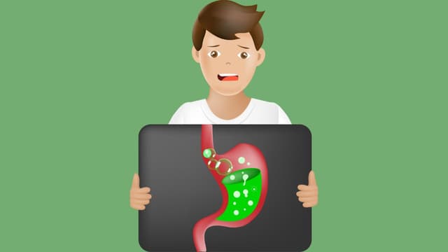 Ợ hơi ợ chua liên tục – Khi nào cần đo pH trở kháng thực quản 24h