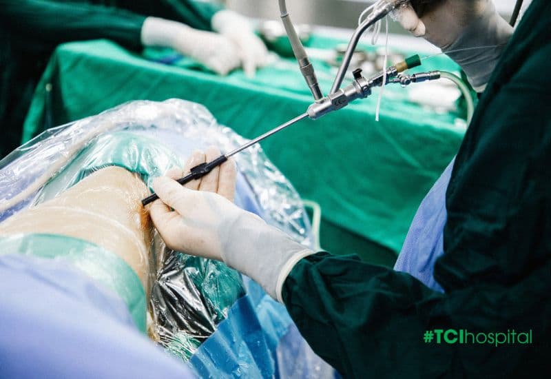 Tán sỏi qua da đường hầm nhỏ kỹ thuật cao: Giải pháp cho sỏi san hô