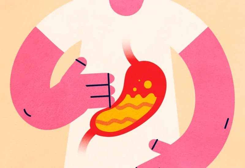 Trào ngược dịch ở dạ dày lên thực quản là gì?