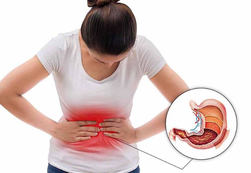 Trào ngược dạ dày có đau bụng không?