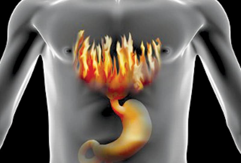 Nguyên nhân gây triệu chứng ợ nóng