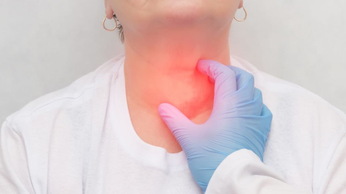 U mỡ ở cổ dễ bị hiểu nhầm là bướu cổ