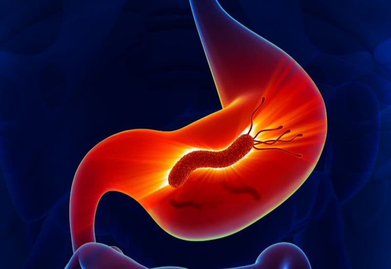 Nguyên nhân gây tình trạng ợ hơi có mùi hôi