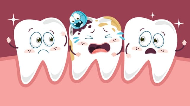 Cao răng ở đâu khó lấy nhất và giải pháp xử lý hiệu quả