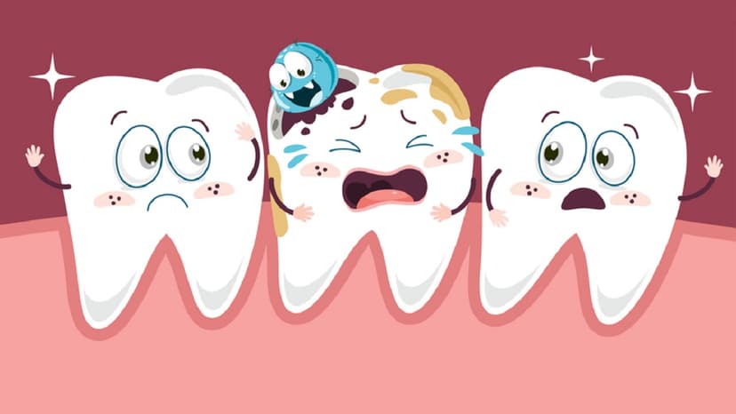 Cao răng ở đâu khó lấy nhất và giải pháp xử lý hiệu quả