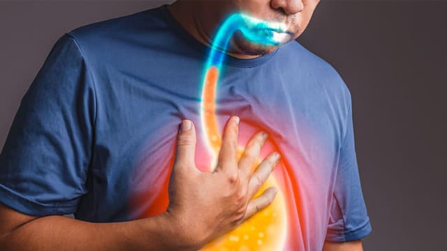 Nguyên nhân gây ho do trào ngược dạ dày và cách khắc phục