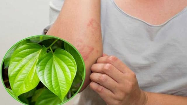 Cẩn trọng trước các mẹo chữa u bã đậu từ dân gian