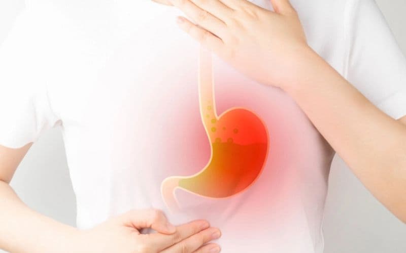 Trào ngược dạ dày thực quản là nguyên nhân phổ biến gây ra ợ chua nhiều