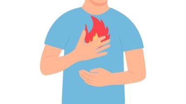 Mối liên hệ giữa ợ chua và nóng với các bệnh lý dạ dày