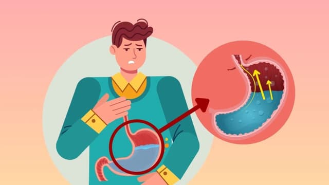 Cách phân biệt nôn trớ và trào ngược chính xác