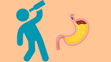 Caffeine và rượu – Hai tác nhân gây ra ợ chua bạn nên tránh