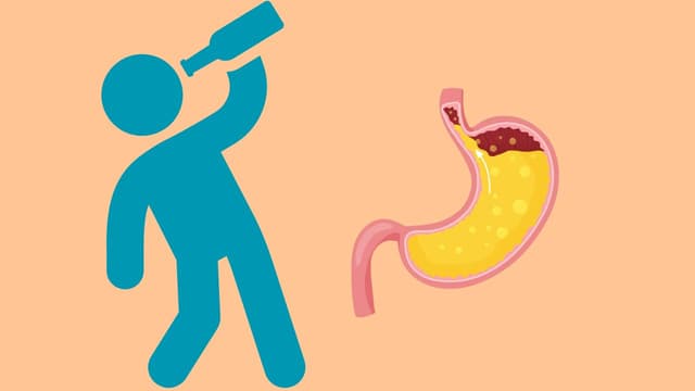 Caffeine và rượu – Hai tác nhân gây ra ợ chua bạn nên tránh