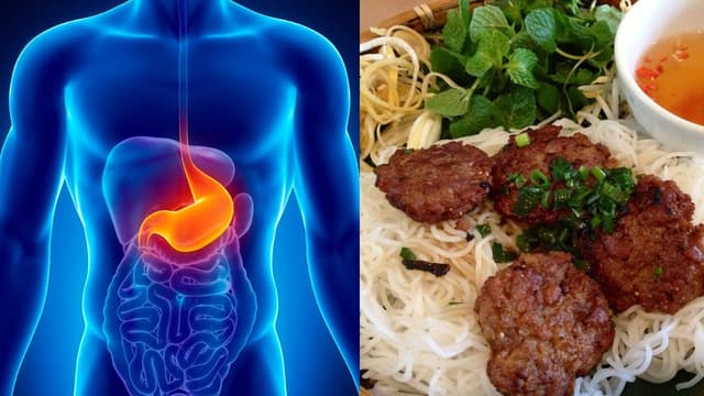 Giải đáp người bị trào ngược dạ dày ăn bún được không