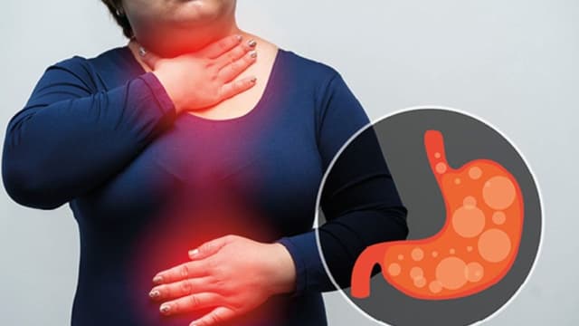 Nguyên nhân trào ngược dạ dày nóng cổ?