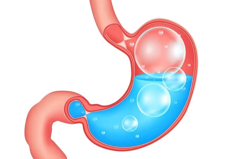 Triệu chứng ợ hơi liên tục cảnh báo bệnh gì?