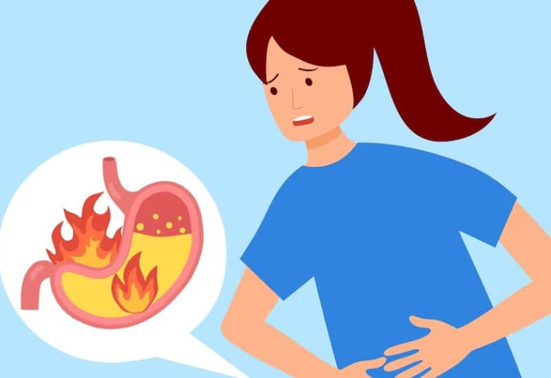 Hiểu về ợ nóng trào ngược dạ dày tái phát