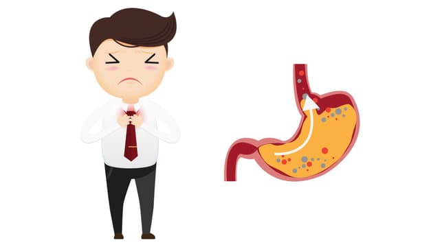 Nên làm gì khi bị ợ chua – Khuyến cáo từ chuyên gia