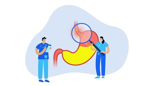 Cách để chẩn đoán nguyên nhân gây ợ chua tức ngực