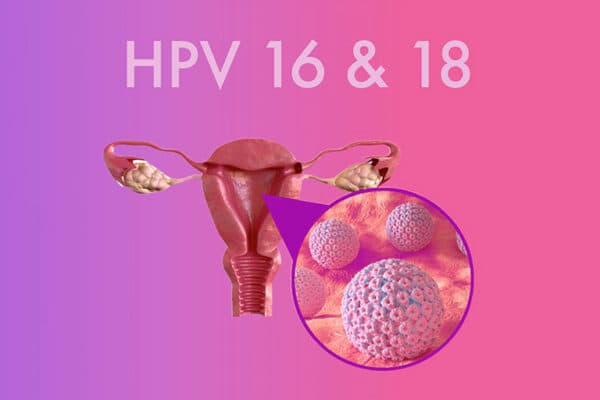 Hai chủng HPV 16 và 18 được xem là nguy hiểm nhất.
