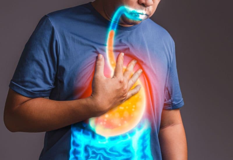 Trào ngược dạ dày thực quản (GERD) có thể gây nuốt nghẹn do ảnh hưởng trực tiếp đến thực quản