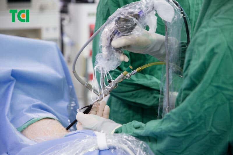 Hiểu đúng về nội soi qua da đường hầm siêu nhỏ