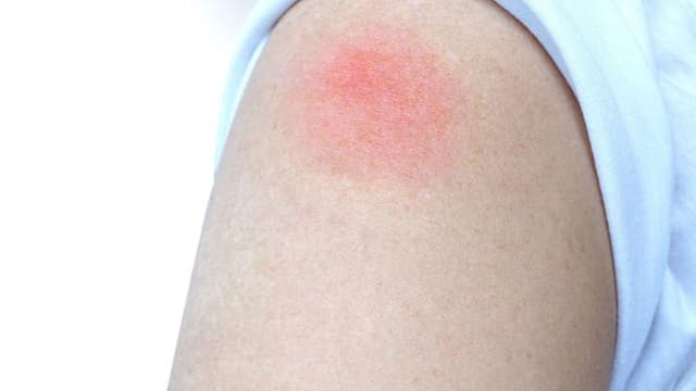 Những điều về thời gian sau khi tiêm vacxin