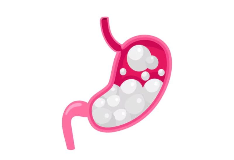 Nguyên nhân bệnh lý gây hiện tượng ợ hơi nhiều