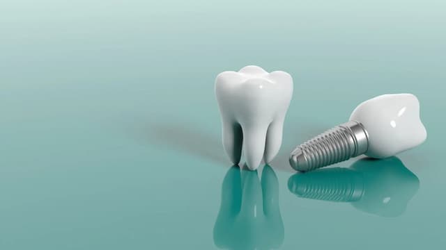 Tư vấn trồng răng implant cho người già: Nên hay không