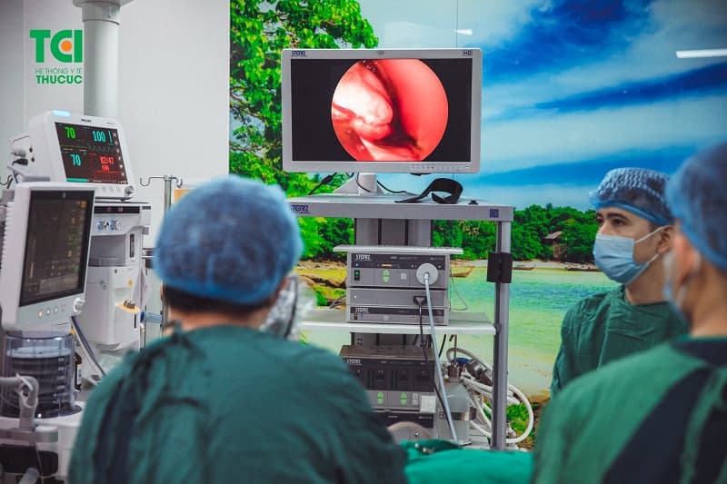 Trong một số trường hợp, xoang mũi cần được xử lý bằng phương pháp phẫu thuật