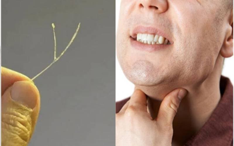 Các cách trị khi bị hóc xương cá