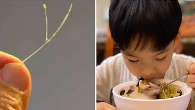 Chữa hóc xương cá nhỏ và thời điểm cần can thiệp y khoa