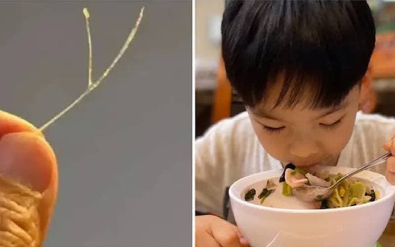 Chữa hóc xương cá nhỏ như nào