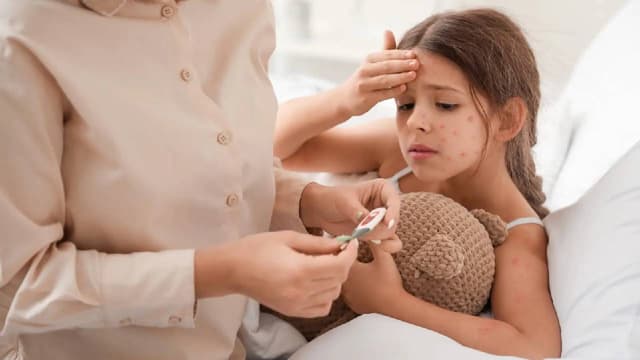 Dấu hiệu của thủy đậu: Nhận biết sớm để bảo vệ trẻ