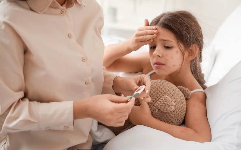 Dấu hiệu của thủy đậu như thế nào