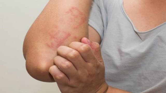 Hướng dẫn đầy đủ và chi tiết về đối tượng không được tiêm vacxin