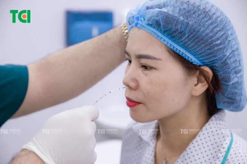 TCI đi đầu trong chẩn đoán miệng ợ chua