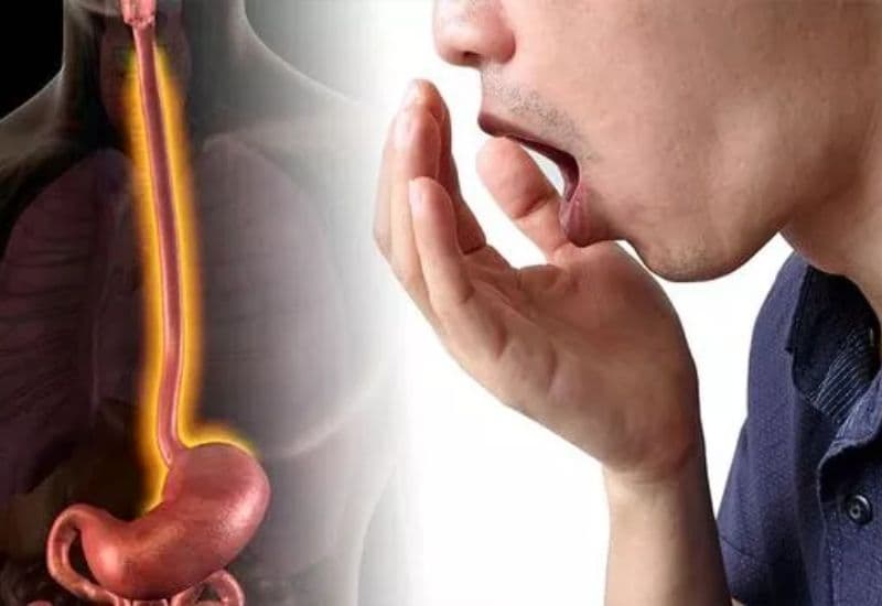 Nguyên nhân gây ợ có mùi hôi