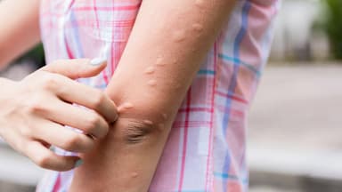 Nên và không nên lo về triệu chứng sau khi tiêm vaccine