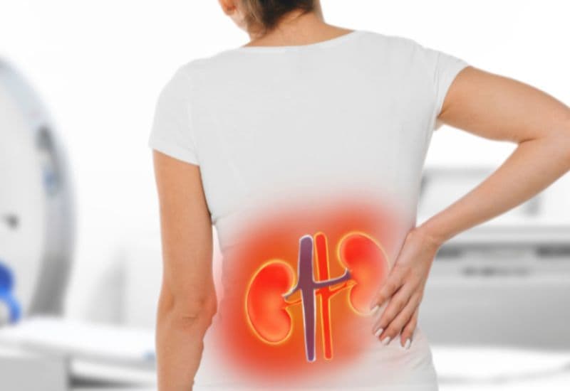 Dấu hiệu nhận biết bệnh giãn đài bể thận độ 2