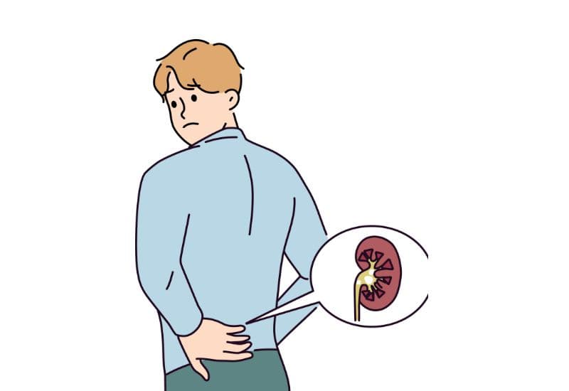 Dấu hiệu cần đi khám ngay khi mắc thận ứ nước gây ra do sỏi niệu quản