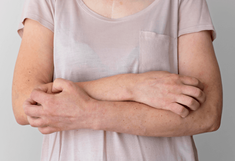 Một số người có thể dị ứng với thuốc này.