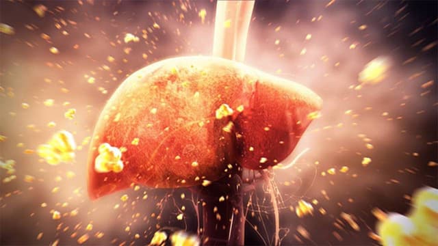 Tổng hợp cách điều trị gan nhiễm mỡ hiệu quả