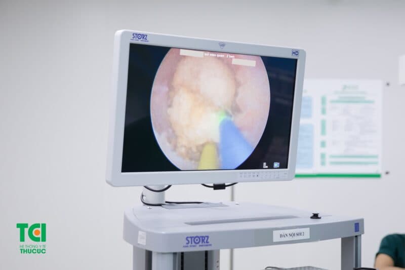 Bệnh nhân thận ứ nước độ 3 có thể điều trị dứt điểm không?