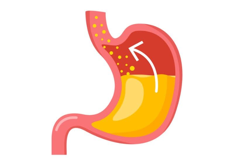 Trào ngược là một trong số những nguyên nhân gây khó nuốt - khó nuốt là bị sao