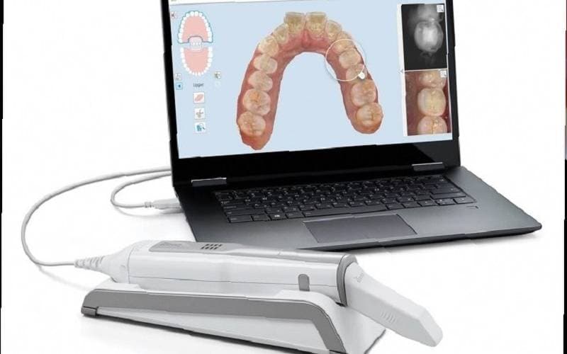 Giá dán Veneer tiết kiệm