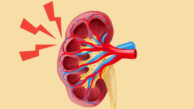 Giãn đài bể thận độ 1 có thể tự khỏi không? Sự thật bạn nên biết