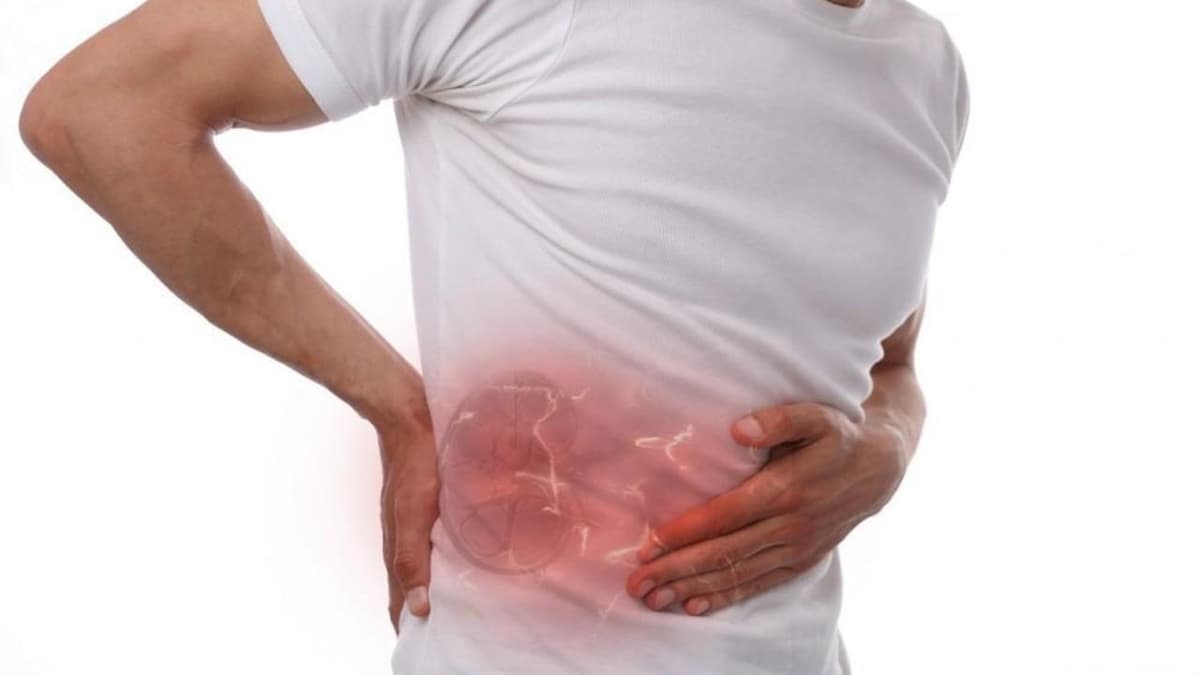 Giãn đài bể thận độ 3: Nguyên nhân, triệu chứng và cách điều trị