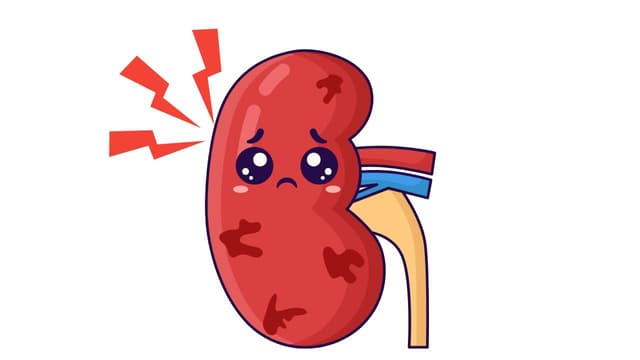 Giãn đài bể thận là gì? Nguyên nhân và cách nhận biết sớm